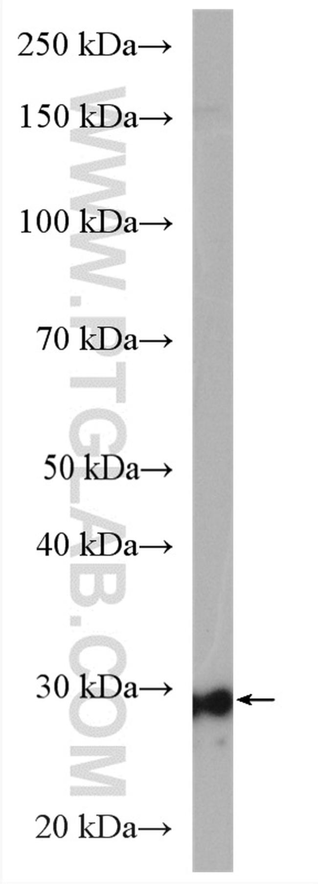 LHPP Antibody in Western Blot (WB)