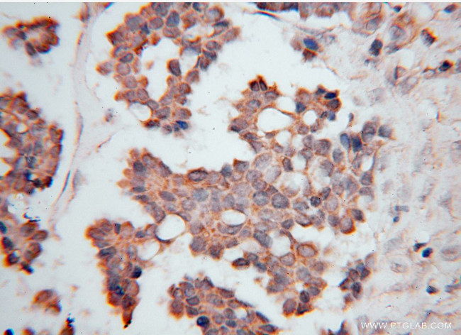 VARS2 Antibody in Immunohistochemistry (Paraffin) (IHC (P))