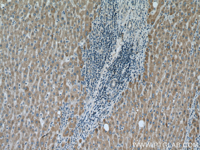 VARS2 Antibody in Immunohistochemistry (Paraffin) (IHC (P))