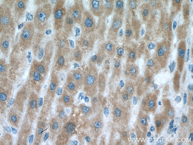 VARS2 Antibody in Immunohistochemistry (Paraffin) (IHC (P))