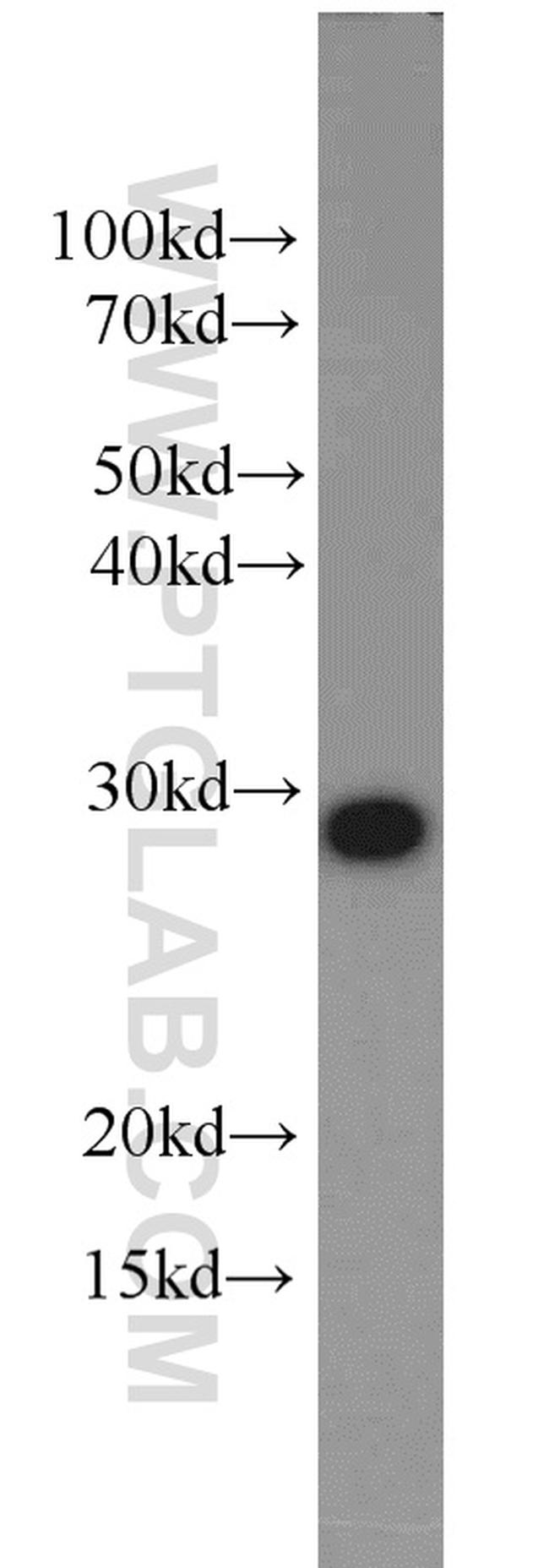 CIP29 Antibody in Western Blot (WB)