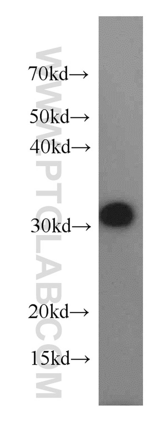 CIP29 Antibody in Western Blot (WB)