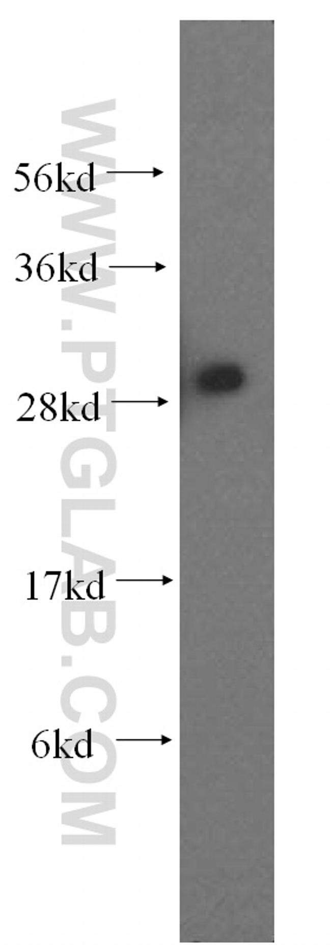 ANP32A Antibody in Western Blot (WB)