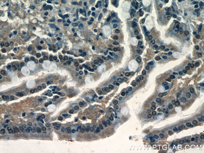 XRCC4 Antibody in Immunohistochemistry (Paraffin) (IHC (P))