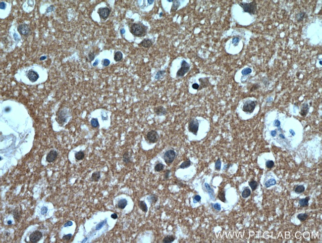 PKM1 Antibody in Immunohistochemistry (Paraffin) (IHC (P))