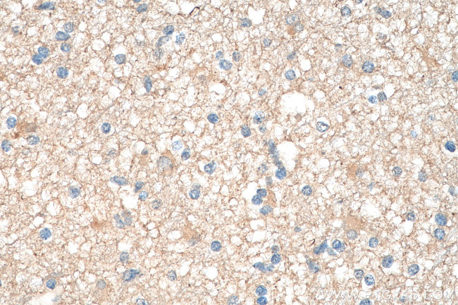 PKM1 Antibody in Immunohistochemistry (Paraffin) (IHC (P))