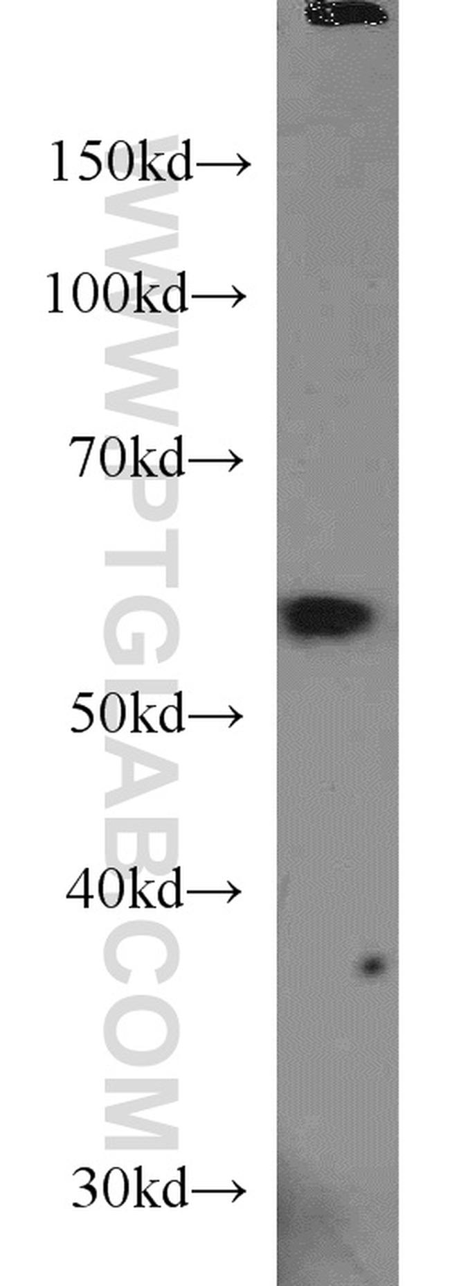 PKM1 Antibody in Western Blot (WB)