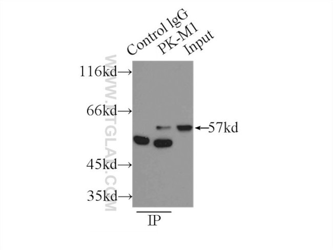 PKM1 Antibody in Immunoprecipitation (IP)