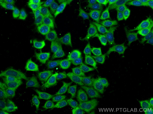 PKM2 Antibody in Immunocytochemistry (ICC/IF)