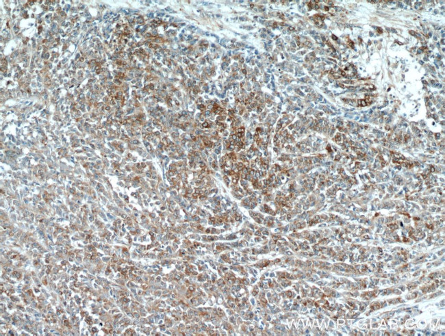 PKM2 Antibody in Immunohistochemistry (Paraffin) (IHC (P))