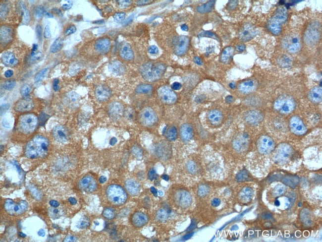 PKM2 Antibody in Immunohistochemistry (Paraffin) (IHC (P))