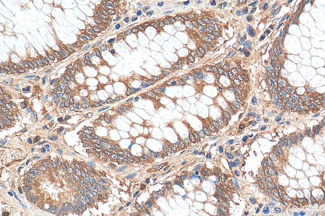 PKM2 Antibody in Immunohistochemistry (Paraffin) (IHC (P))