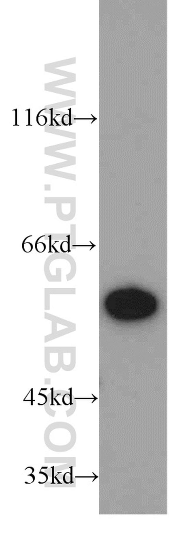 PKM2 Antibody in Western Blot (WB)