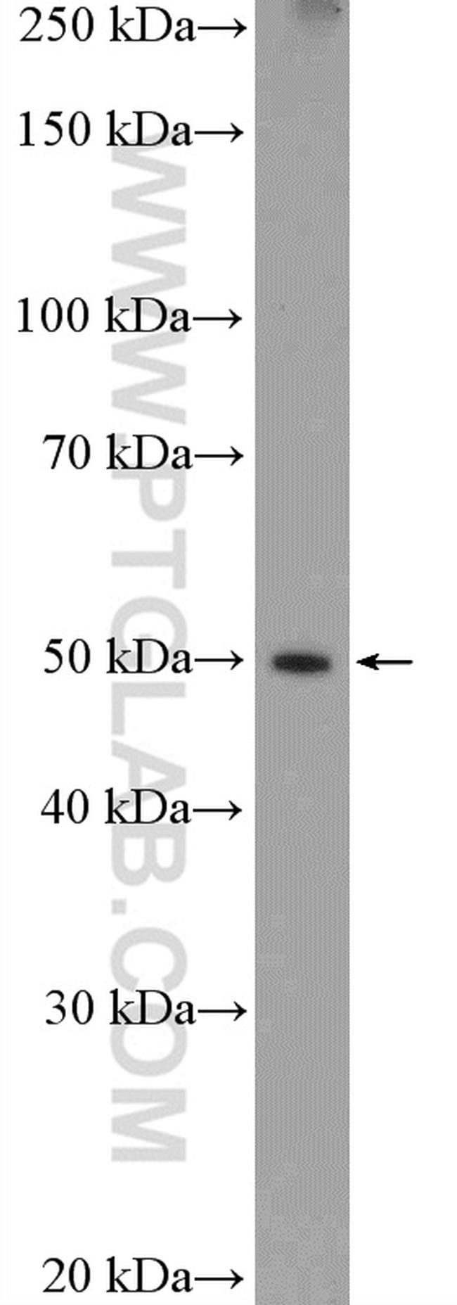 PKM2 Antibody in Western Blot (WB)