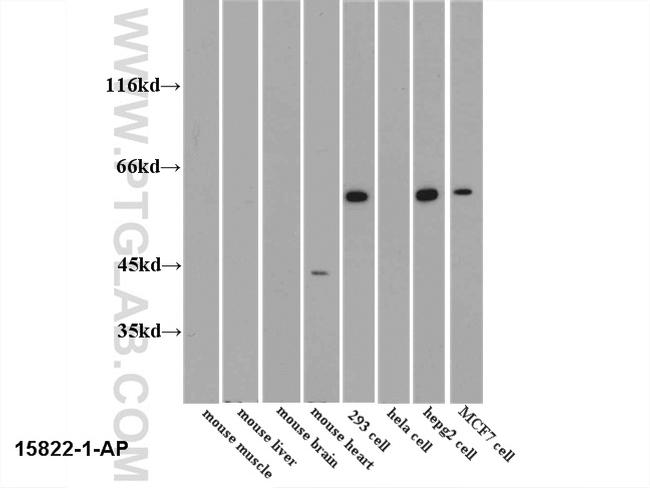 PKM2 Antibody in Western Blot (WB)