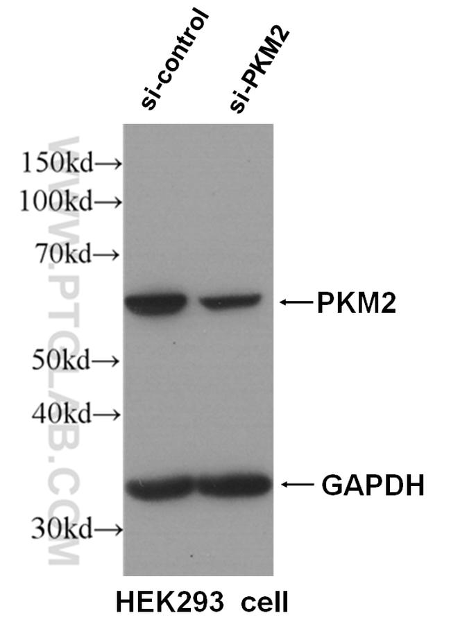 PKM2 Antibody in Western Blot (WB)