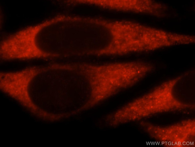 UBASH3A Antibody in Immunocytochemistry (ICC/IF)