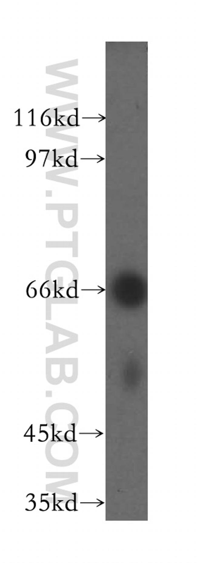 UBASH3A Antibody in Western Blot (WB)