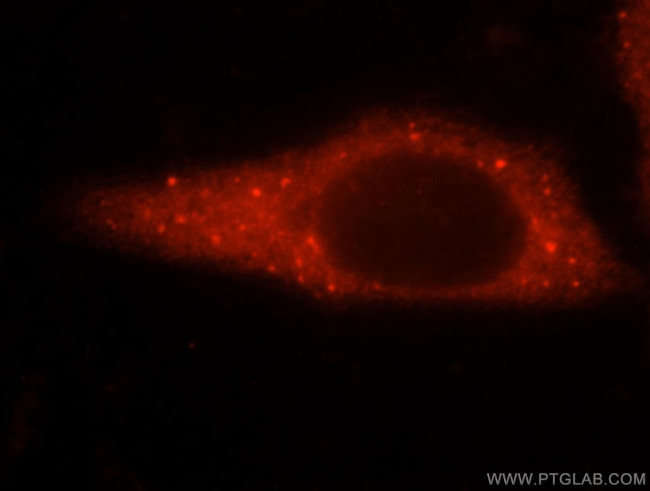 GARS Antibody in Immunocytochemistry (ICC/IF)