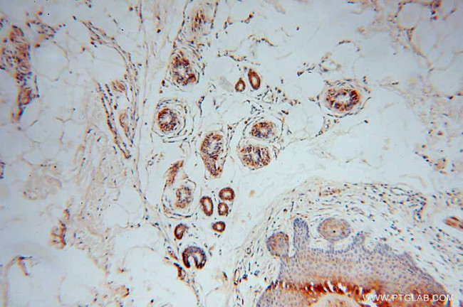 GARS Antibody in Immunohistochemistry (Paraffin) (IHC (P))