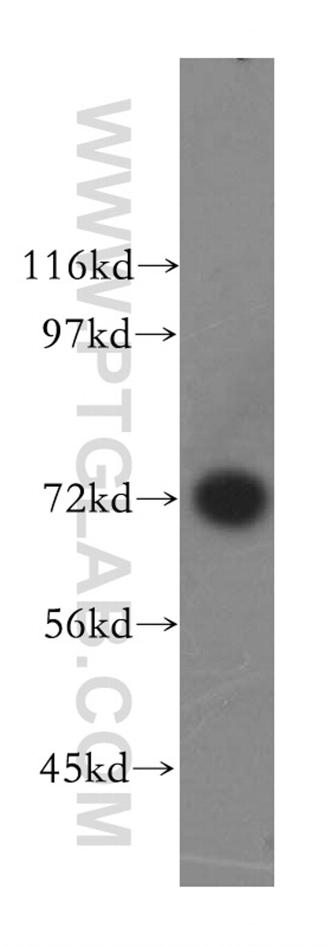 GARS Antibody in Western Blot (WB)