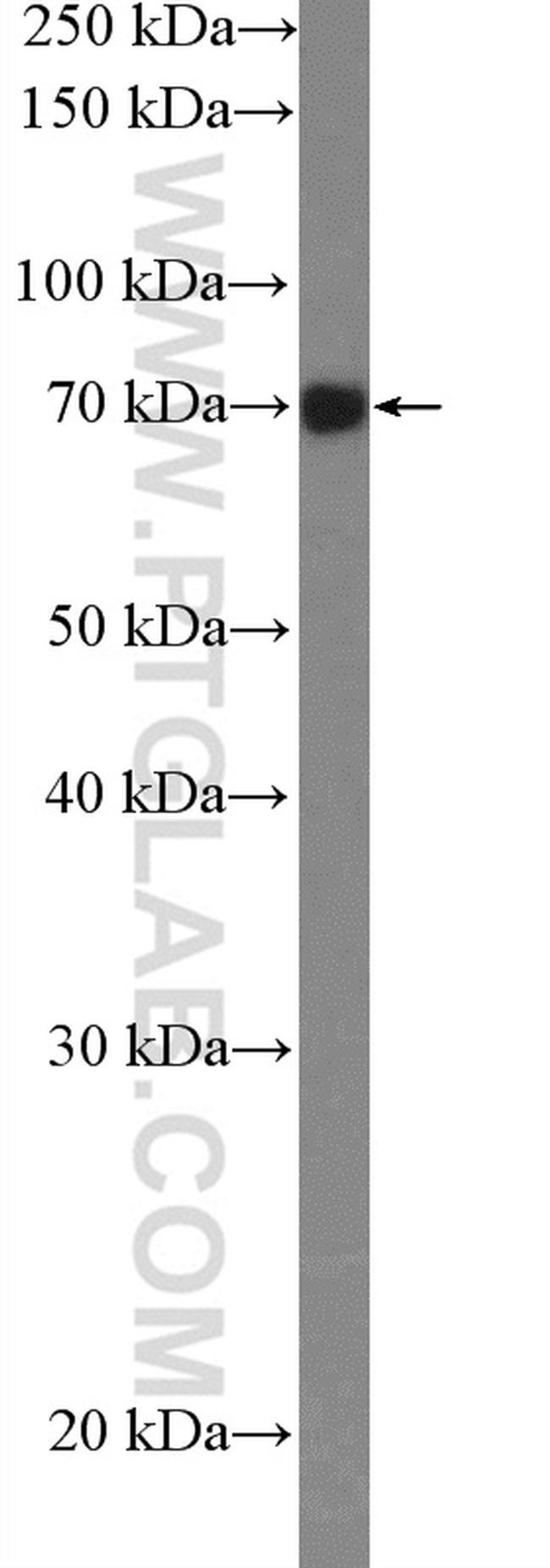 GARS Antibody in Western Blot (WB)