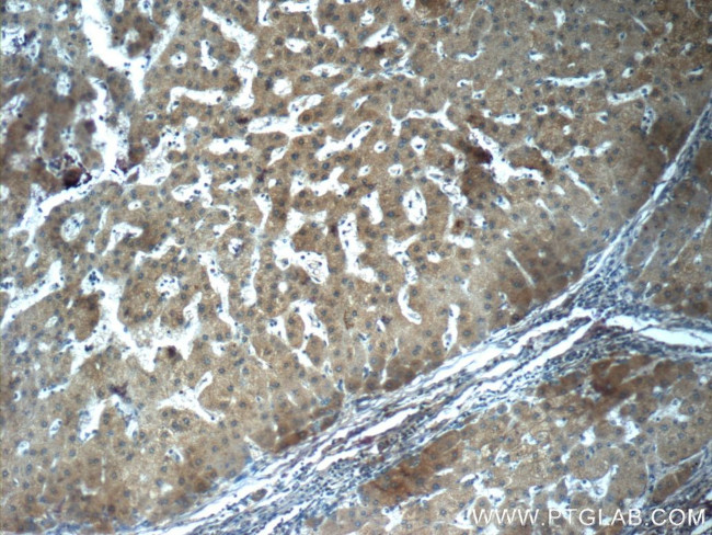 Fibrinogen gamma chain Antibody in Immunohistochemistry (Paraffin) (IHC (P))