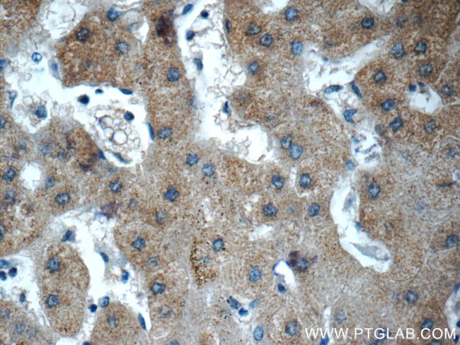 Fibrinogen gamma chain Antibody in Immunohistochemistry (Paraffin) (IHC (P))