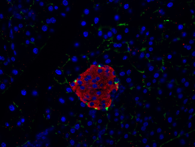 Insulin Antibody in Immunocytochemistry (ICC/IF)