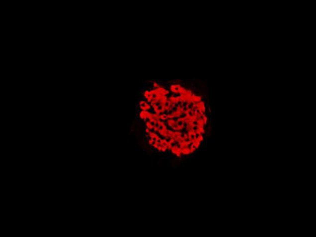 Insulin Antibody in Immunohistochemistry (IHC)