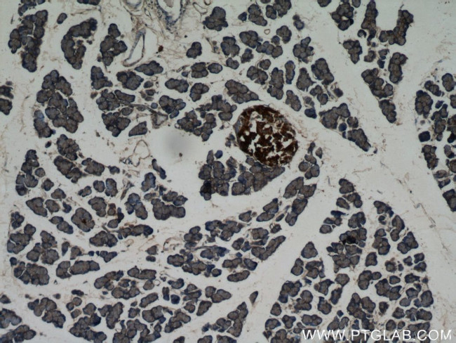 Insulin Antibody in Immunohistochemistry (Paraffin) (IHC (P))