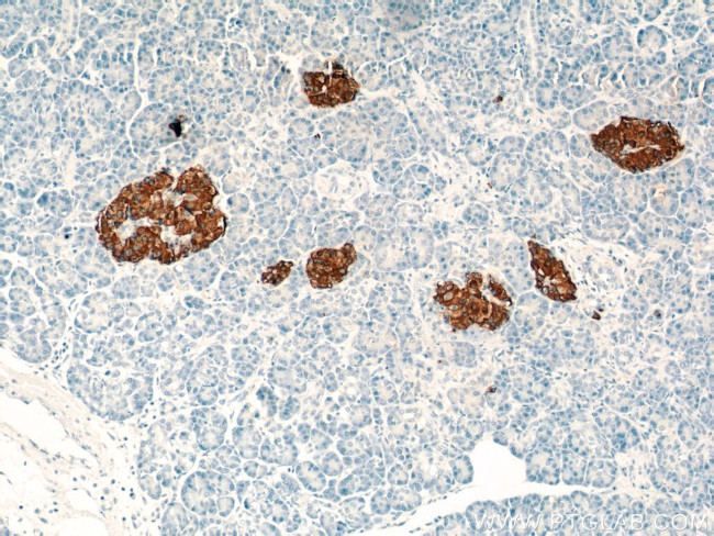 Insulin Antibody in Immunohistochemistry (Paraffin) (IHC (P))