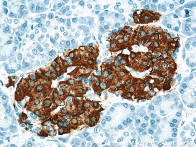 Insulin Antibody in Immunohistochemistry (Paraffin) (IHC (P))