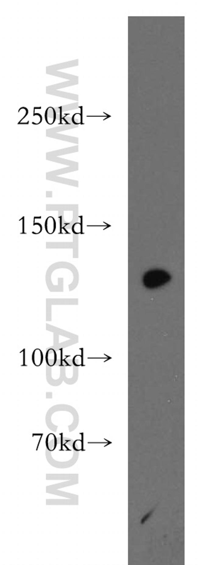 SF3A1 Antibody in Western Blot (WB)