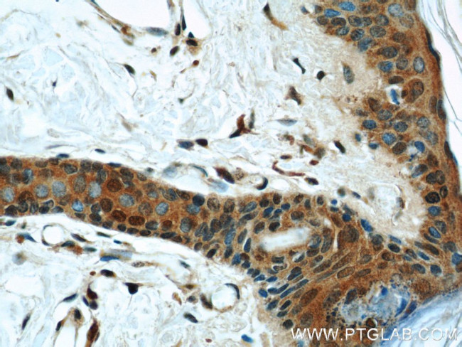 FABP4 Antibody in Immunohistochemistry (Paraffin) (IHC (P))