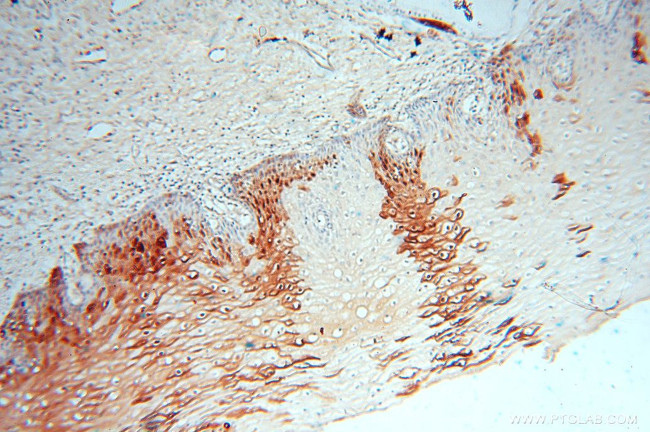 FABP4 Antibody in Immunohistochemistry (Paraffin) (IHC (P))