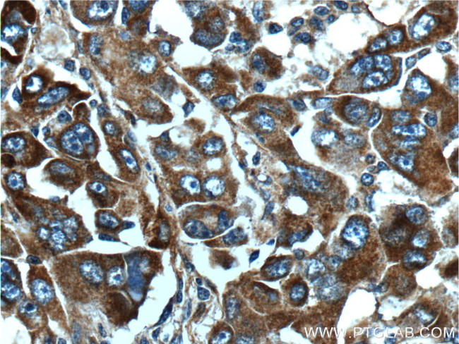 TDO2 Antibody in Immunohistochemistry (Paraffin) (IHC (P))