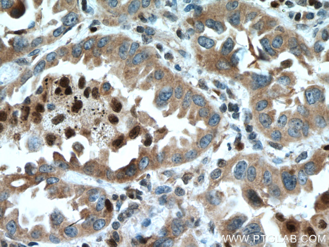 UFM1 Antibody in Immunohistochemistry (Paraffin) (IHC (P))