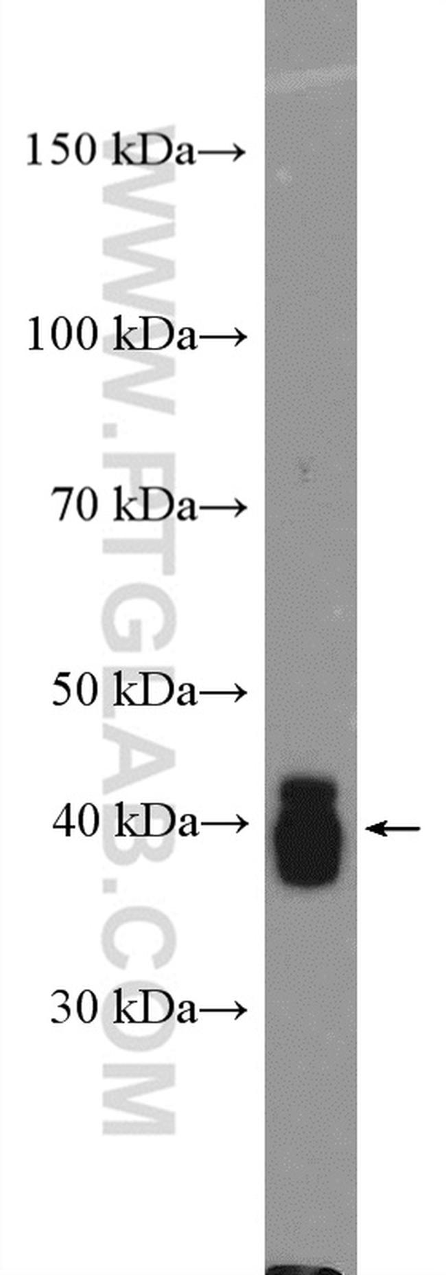 CKM/CKB Antibody in Western Blot (WB)