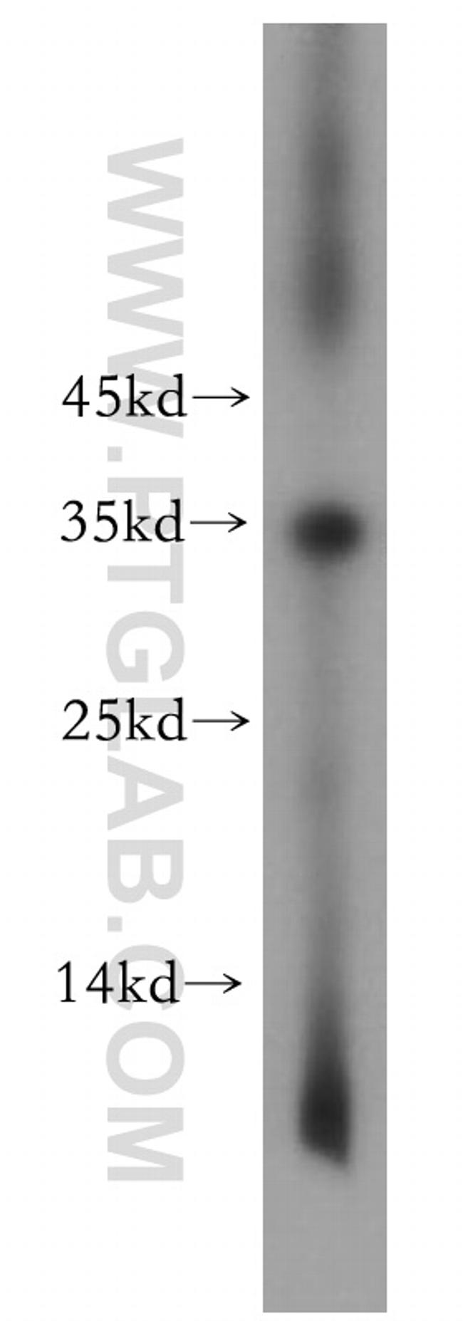 TNNT1 Antibody in Western Blot (WB)