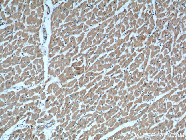 RAB11A/B Antibody in Immunohistochemistry (Paraffin) (IHC (P))