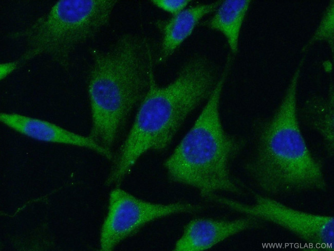 RAB11A/B Antibody in Immunocytochemistry (ICC/IF)