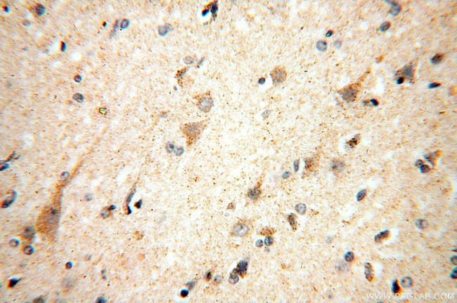 IDH3A Antibody in Immunohistochemistry (Paraffin) (IHC (P))