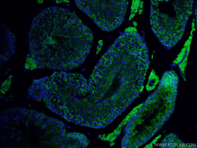 ALDH1A1 Antibody in Immunohistochemistry (PFA fixed) (IHC (PFA))