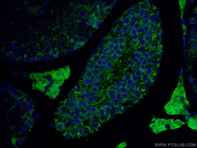 ALDH1A1 Antibody in Immunohistochemistry (PFA fixed) (IHC (PFA))