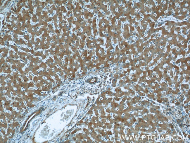 ALDH1A1 Antibody in Immunohistochemistry (Paraffin) (IHC (P))