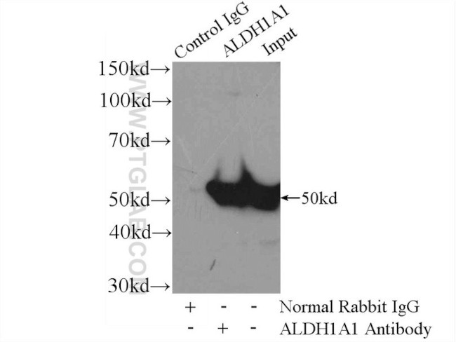 ALDH1A1 Antibody in Immunoprecipitation (IP)