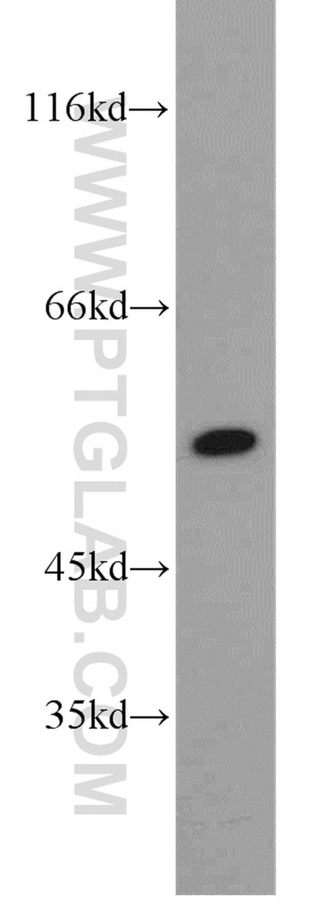 ALDH1A1 Antibody in Western Blot (WB)