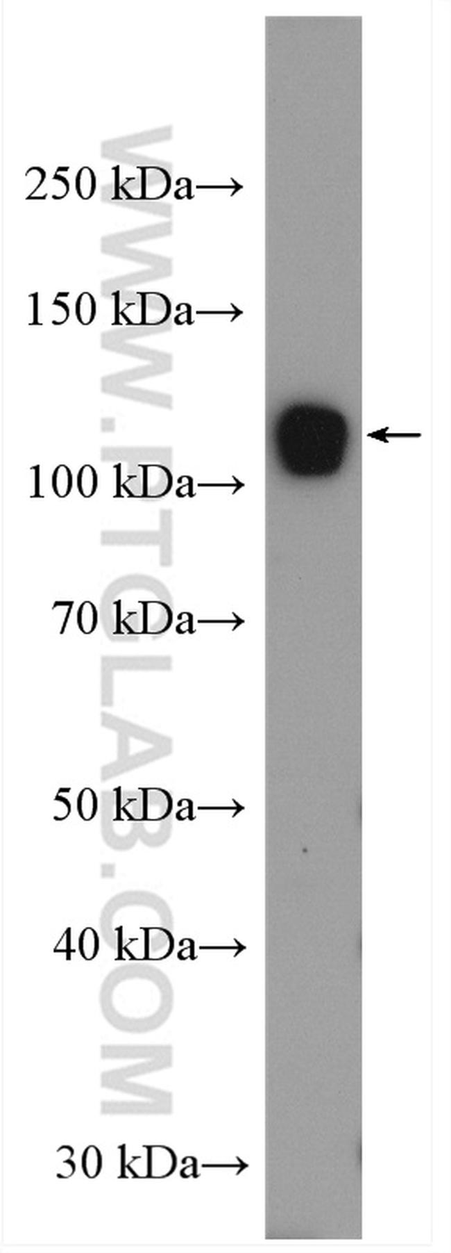 UBE1 Antibody in Western Blot (WB)