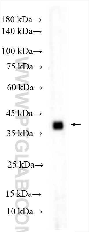 AMACR/p504S Antibody in Western Blot (WB)